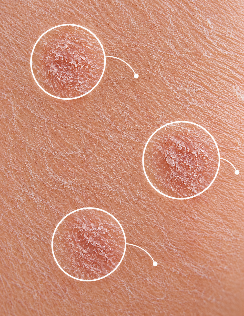 Dry Skin
