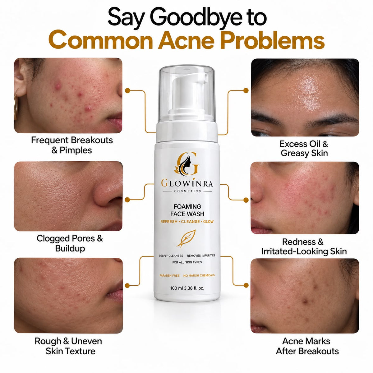 Acne Foaming Face Wash For Clearer Skin