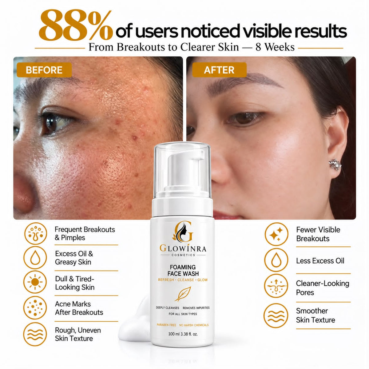 Acne Foaming Face Wash For Clearer Skin