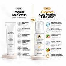 Acne Foaming Face Wash For Clearer Skin